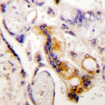 Fibrinogen alpha Rabbit Monoclonal Antibody