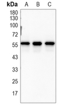 Pyruvate Kinase Rabbit Monoclonal Antibody