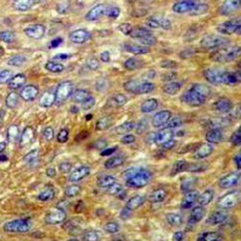 Pyruvate Kinase Rabbit Monoclonal Antibody
