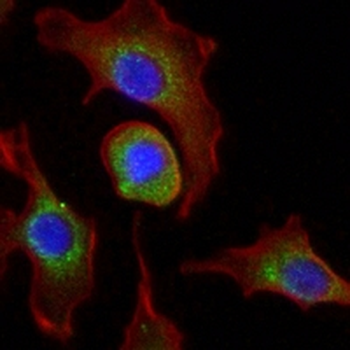 Pyruvate Kinase Rabbit Monoclonal Antibody