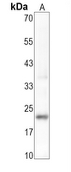 Prolactin Rabbit Monoclonal Antibody