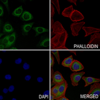Prolactin Rabbit Monoclonal Antibody