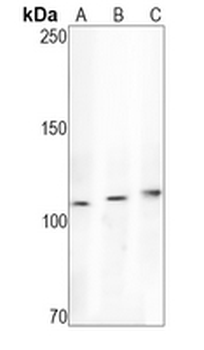 RB1 Rabbit Monoclonal Antibody