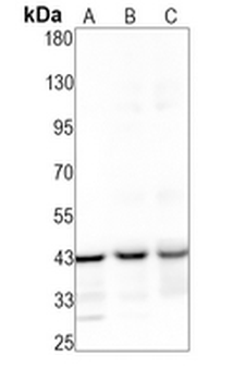 TRAM2 Rabbit Monoclonal Antibody