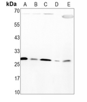IL-1 beta Rabbit Monoclonal Antibody