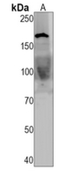 NUP153 Rabbit Monoclonal Antibody