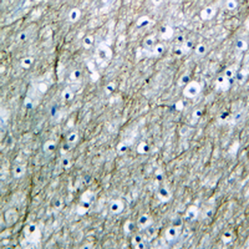 TAU (Phospho-S713/396) Rabbit Monoclonal Antibody
