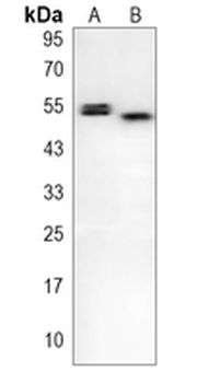 CHK1 Rabbit Monoclonal Antibody