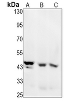 MMP12 Rabbit Monoclonal Antibody