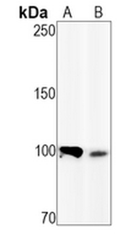 Nucleolin (Phospho-T84) Rabbit Monoclonal Antibody