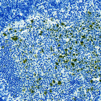 Nucleolin (Phospho-T84) Rabbit Monoclonal Antibody