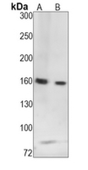 SMC1A (Phospho-S957) Rabbit Monoclonal Antibody