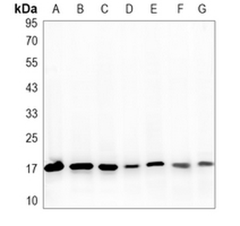 Histone H3 (Phospho-S10) Rabbit Monoclonal Antibody