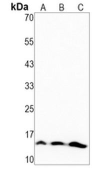 Histone H3 (Phospho-S31) Rabbit Monoclonal Antibody