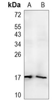 PIP Rabbit Monoclonal Antibody