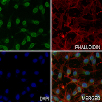 RANGAP1 Rabbit Monoclonal Antibody