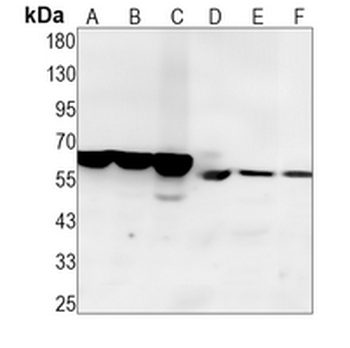 ABCE1 Rabbit Monoclonal Antibody