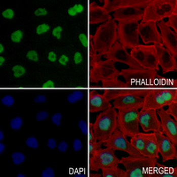 TARBP2 Rabbit Monoclonal Antibody