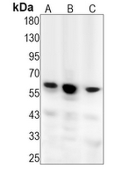 CDC73 Rabbit Monoclonal Antibody