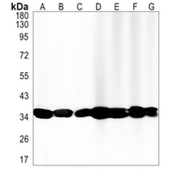 MDH2 Rabbit Monoclonal Antibody