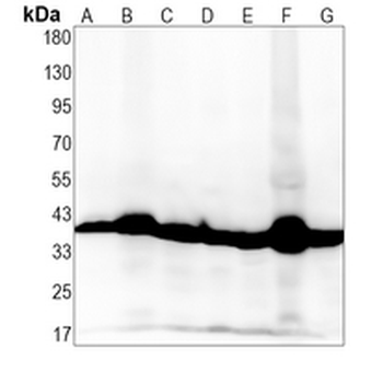 PDHB Rabbit Monoclonal Antibody