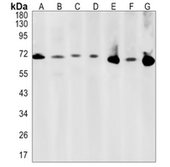 PCK2 Rabbit Monoclonal Antibody