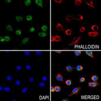 ATG4A Rabbit Monoclonal Antibody