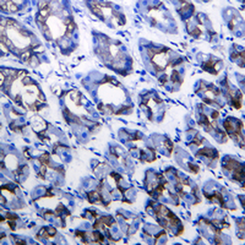 LC3B Rabbit Monoclonal Antibody