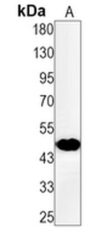 Cyclin E1 Rabbit Monoclonal Antibody