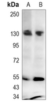 JAK2 Rabbit Monoclonal Antibody