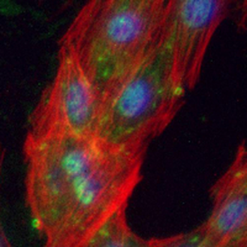 JAK2 Rabbit Monoclonal Antibody