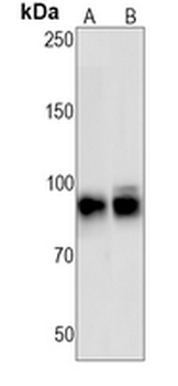 PARP1 (Cleaved-D214) Rabbit Monoclonal Antibody