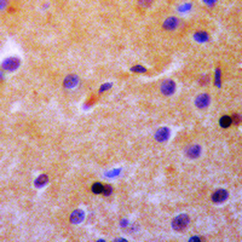 Synaptophysin Rabbit Monoclonal Antibody