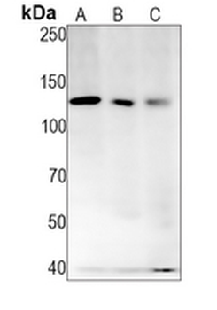 NOTCH1 Rabbit Monoclonal Antibody