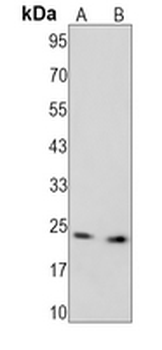 PARP1 (Cleaved-D214) Rabbit Monoclonal Antibody