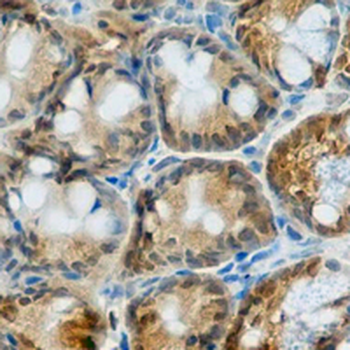 PKC beta Rabbit Monoclonal Antibody