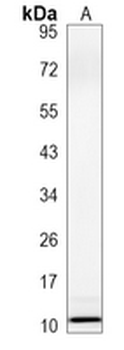 UQCRH Rabbit Monoclonal Antibody