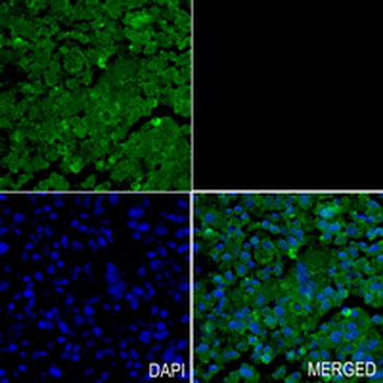 RAB8A Rabbit Monoclonal Antibody