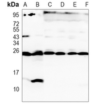 Peroxiredoxin 6 Rabbit Monoclonal Antibody