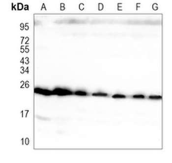 RAB7A Rabbit Monoclonal Antibody