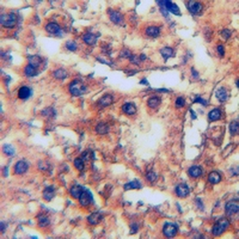 CPS1 Rabbit Monoclonal Antibody