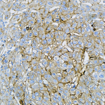 CD36L1 Rabbit Monoclonal Antibody