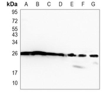 HMGB1 Rabbit Monoclonal Antibody