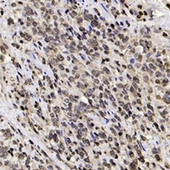HMGB1 Rabbit Monoclonal Antibody