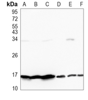 TRAPPC2 Rabbit Monoclonal Antibody