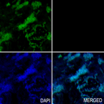 TRAPPC2 Rabbit Monoclonal Antibody