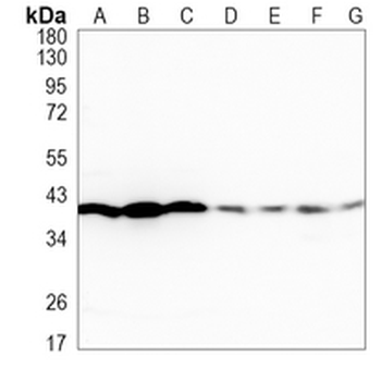 ERK2 Rabbit Monoclonal Antibody