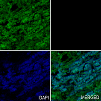ERK2 Rabbit Monoclonal Antibody