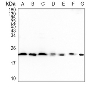CSN8 Rabbit Monoclonal Antibody