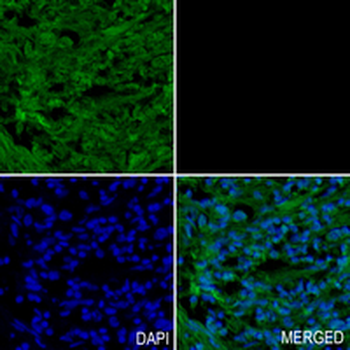 TAPP1 Rabbit Monoclonal Antibody